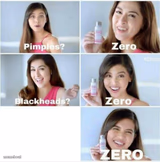 Pimples? Zero