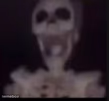 screaming skeleton