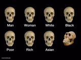 Skull idiot
