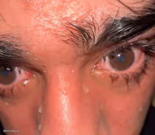 Sweaty Red Eyes