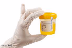 Urine sample - meme generator image preview