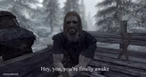 your finally awake