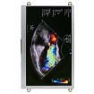 NHD-7.0-HDMI-N-RSXP TFT Displays & Accessories