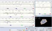 SW-MTI  Embedded Solutions