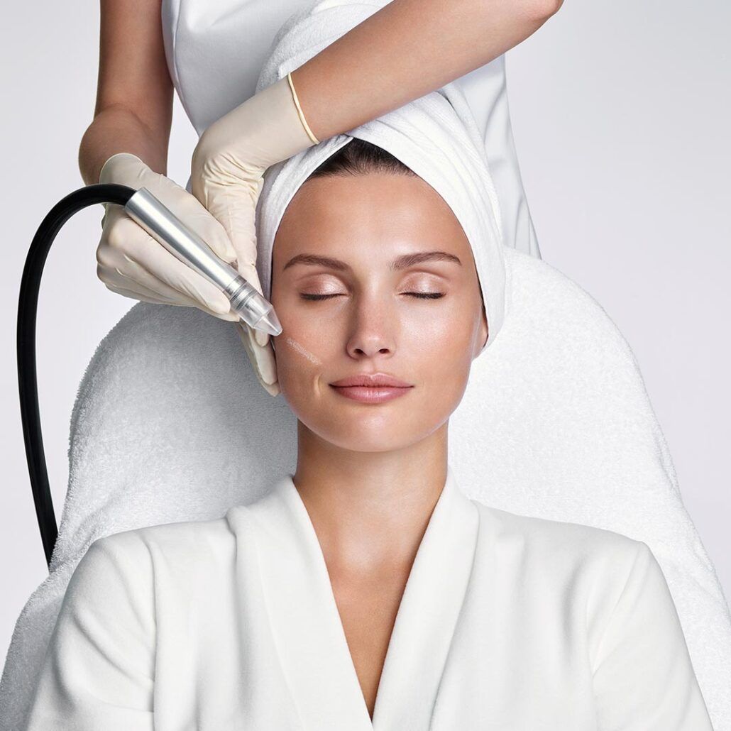 Microdermabrasion: revolutionary skin treatment technology