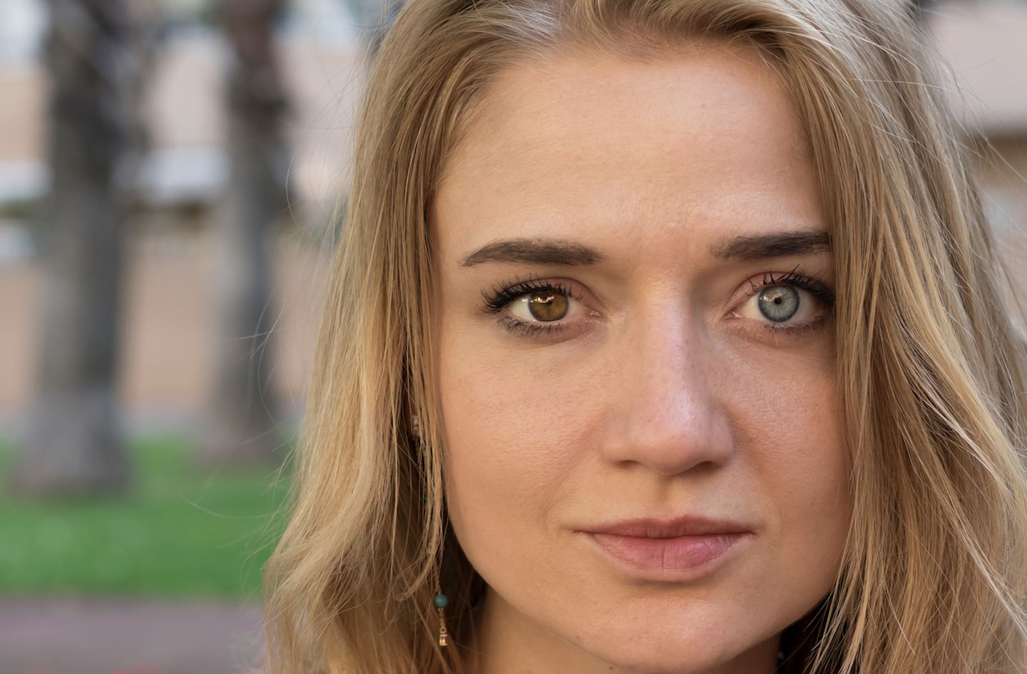 Heterochromia and Pregnancy, image size:1440x945