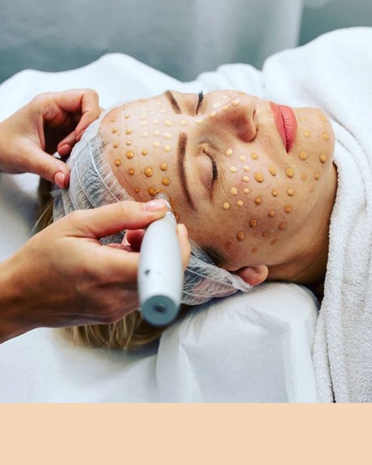 BBGlow con microagujas