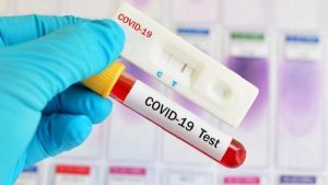 Covid-19 test kits