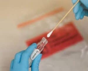 Trichomoniasis PCR Home Test & what virus to avoid.