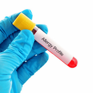 Fruit Allergy test tube image