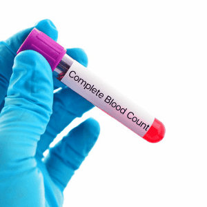 Full CBC Complete Blood Count test for home image