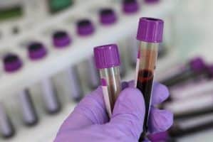 Mineral Blood Tests: What is the importance? 13 –