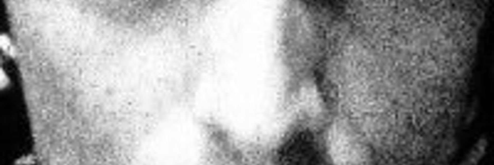 Aro