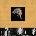 Organoid