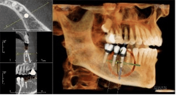 Ashton Avenue Dental Practice - Dentists In Claremont