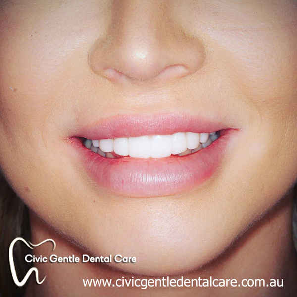 Civic Gentle Dental Care - Dentists In Canberra