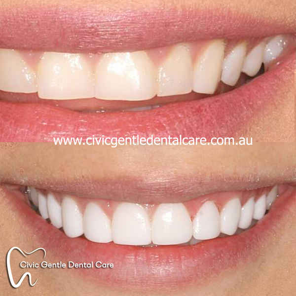 Civic Gentle Dental Care - Dentists In Canberra