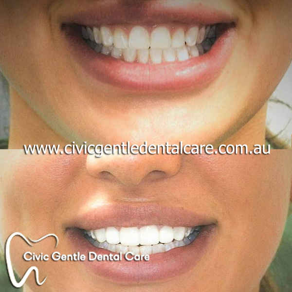 Civic Gentle Dental Care - Dentists In Canberra