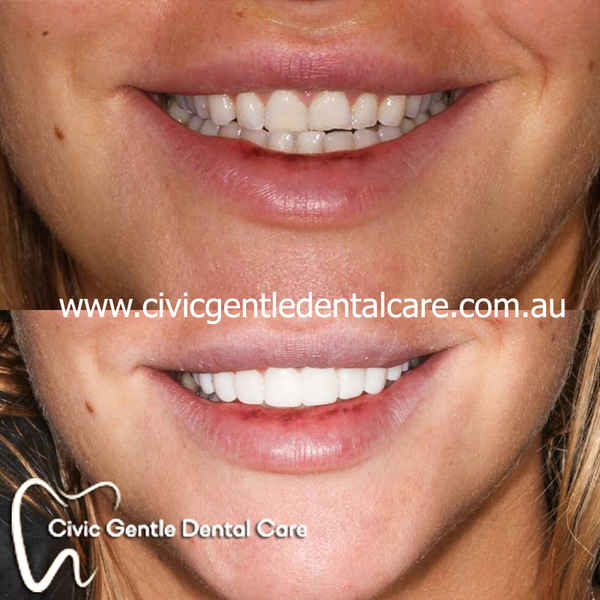 Civic Gentle Dental Care - Dentists In Canberra