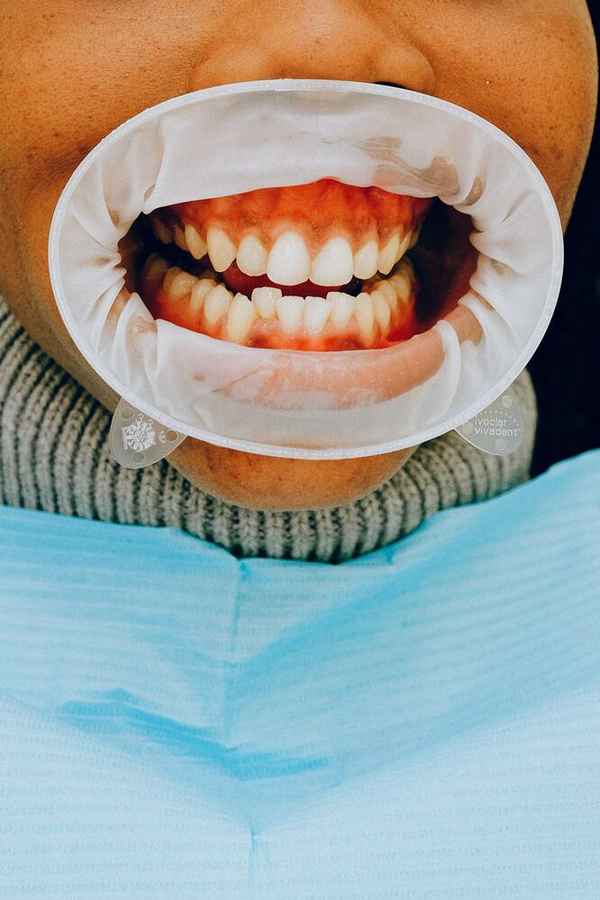 Sandgate Bayside Dental - Dentists In Sandgate