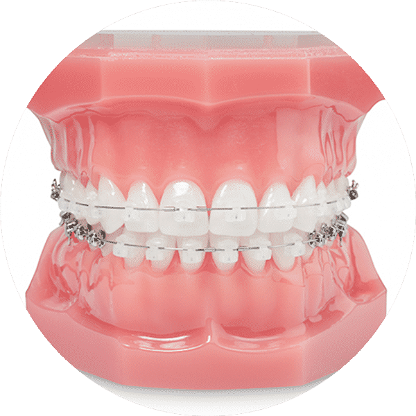 FOX ORTHODONTICS - Orthodontists In Baulkham Hills