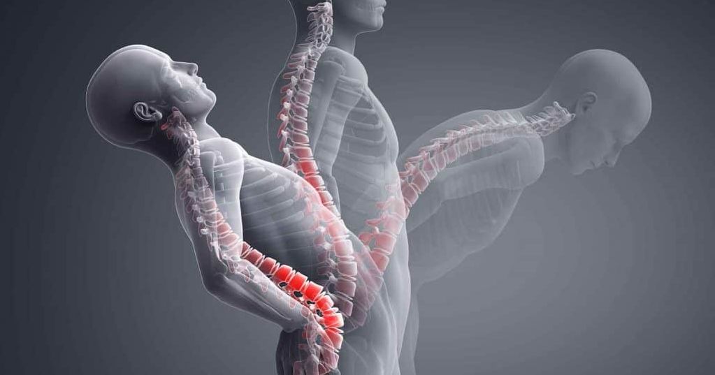 3D illustration of the human spine highlighting the lumbar region in red during bending and extension movements, showing areas affected by dysfunction.