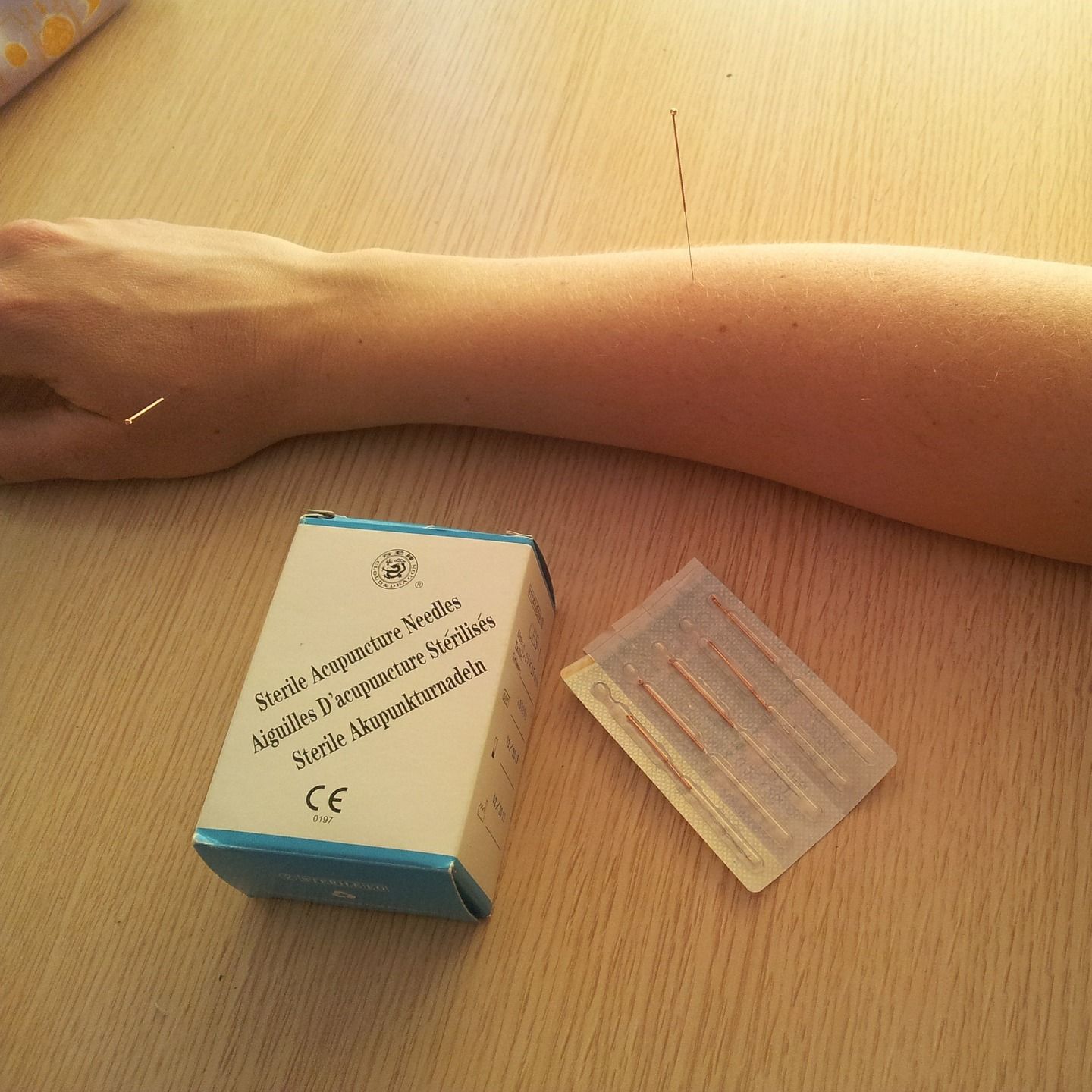 acupuncture