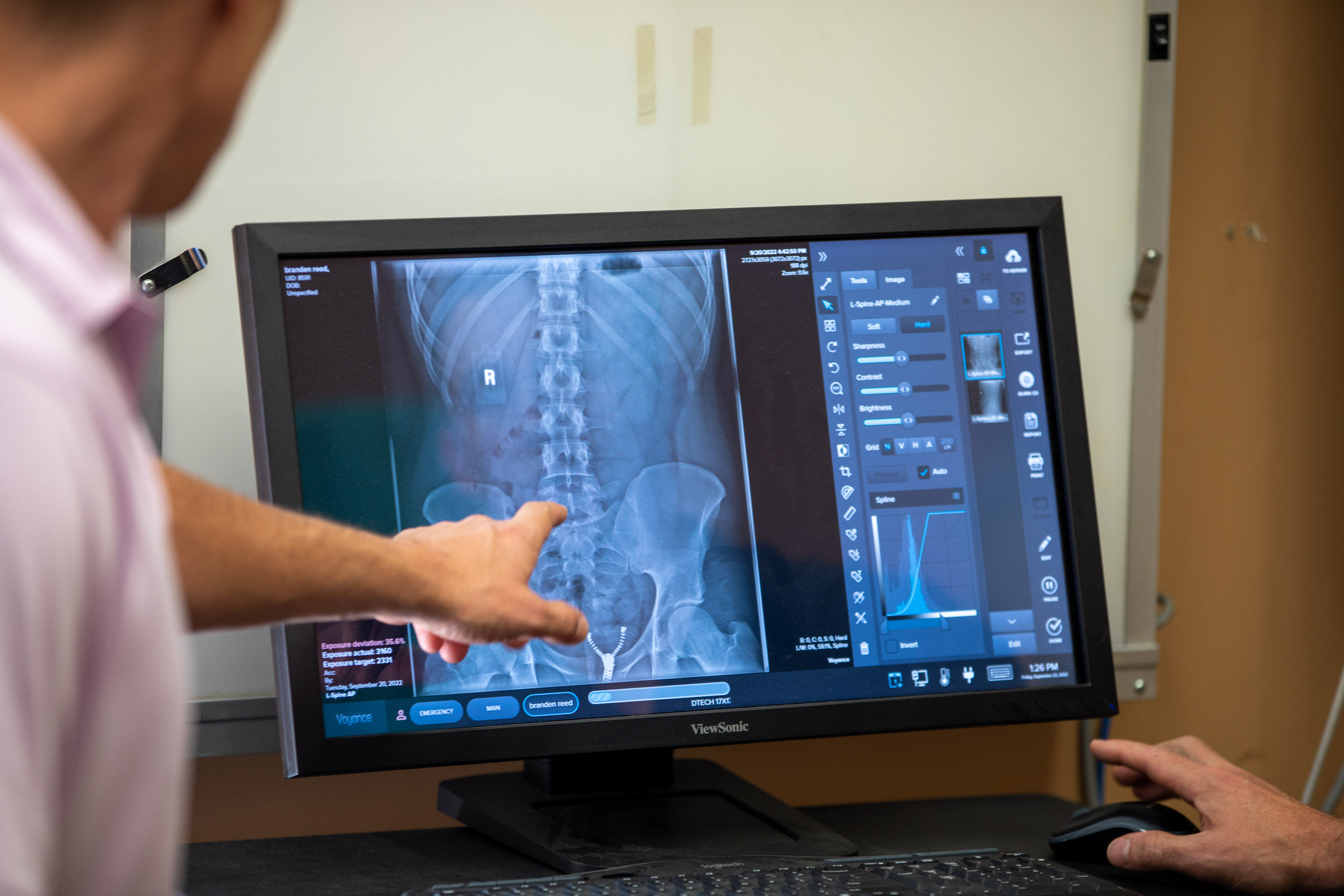 chiropractor pointing to x-ray