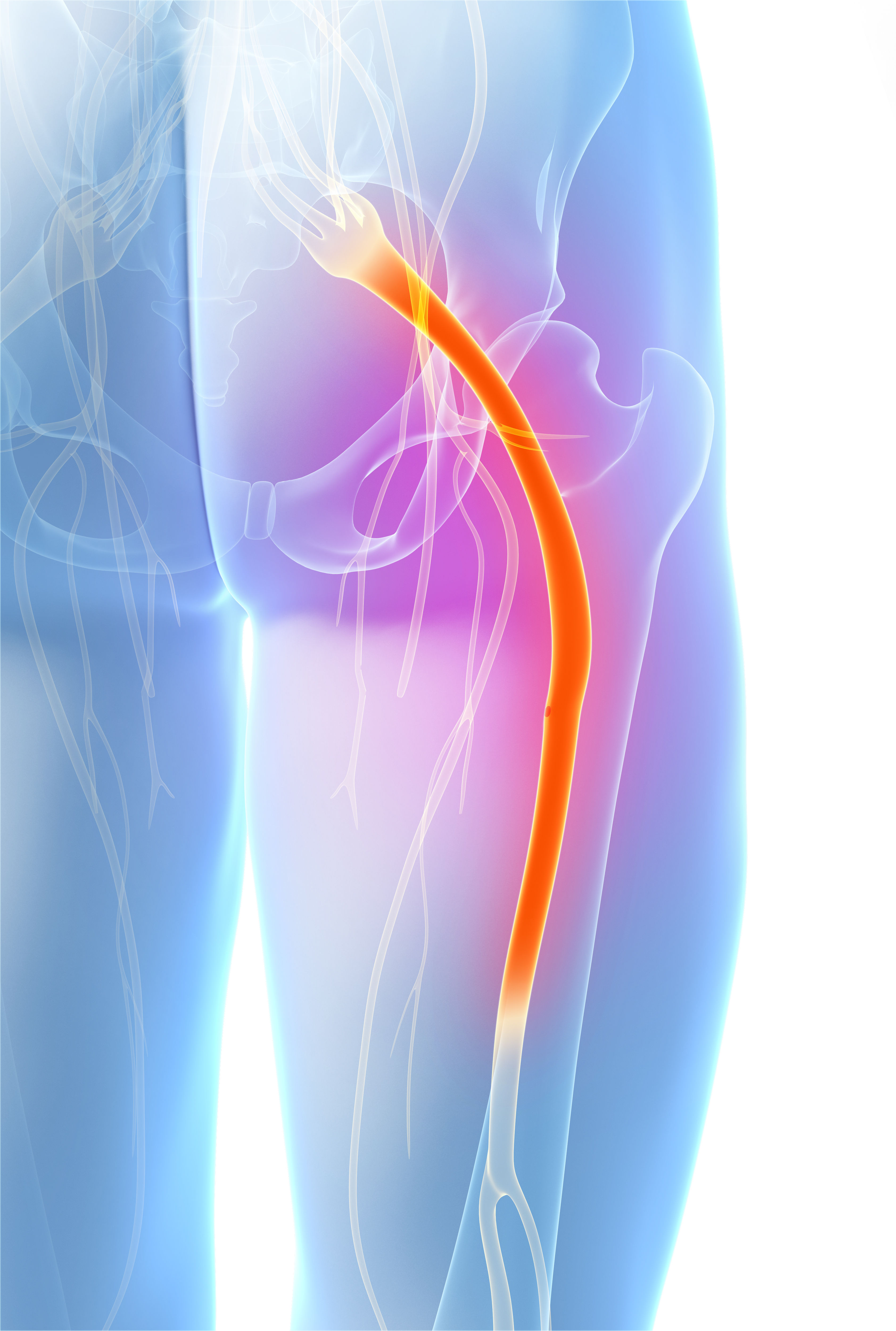 painful sciatic nerve