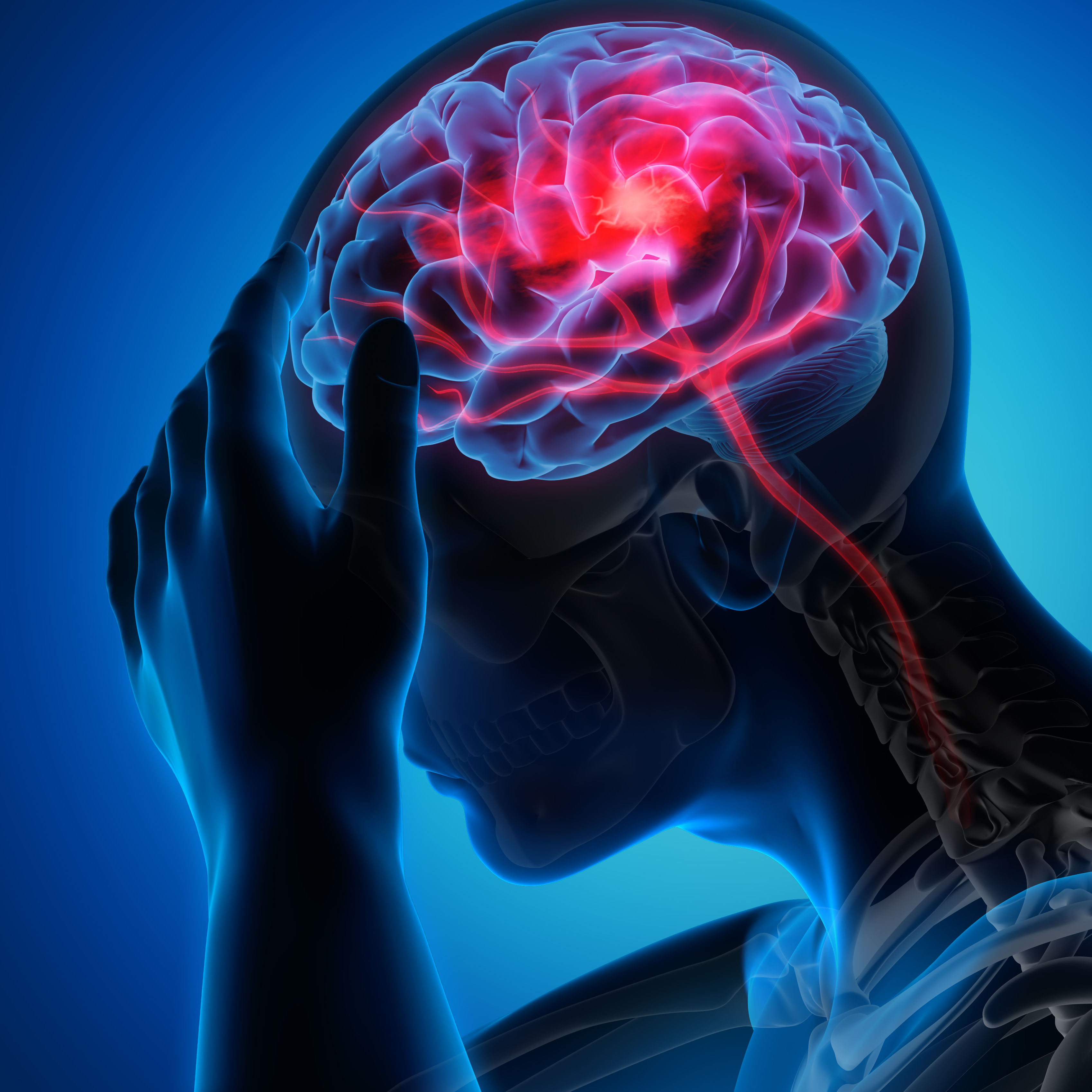 Man with brain stroke symptoms