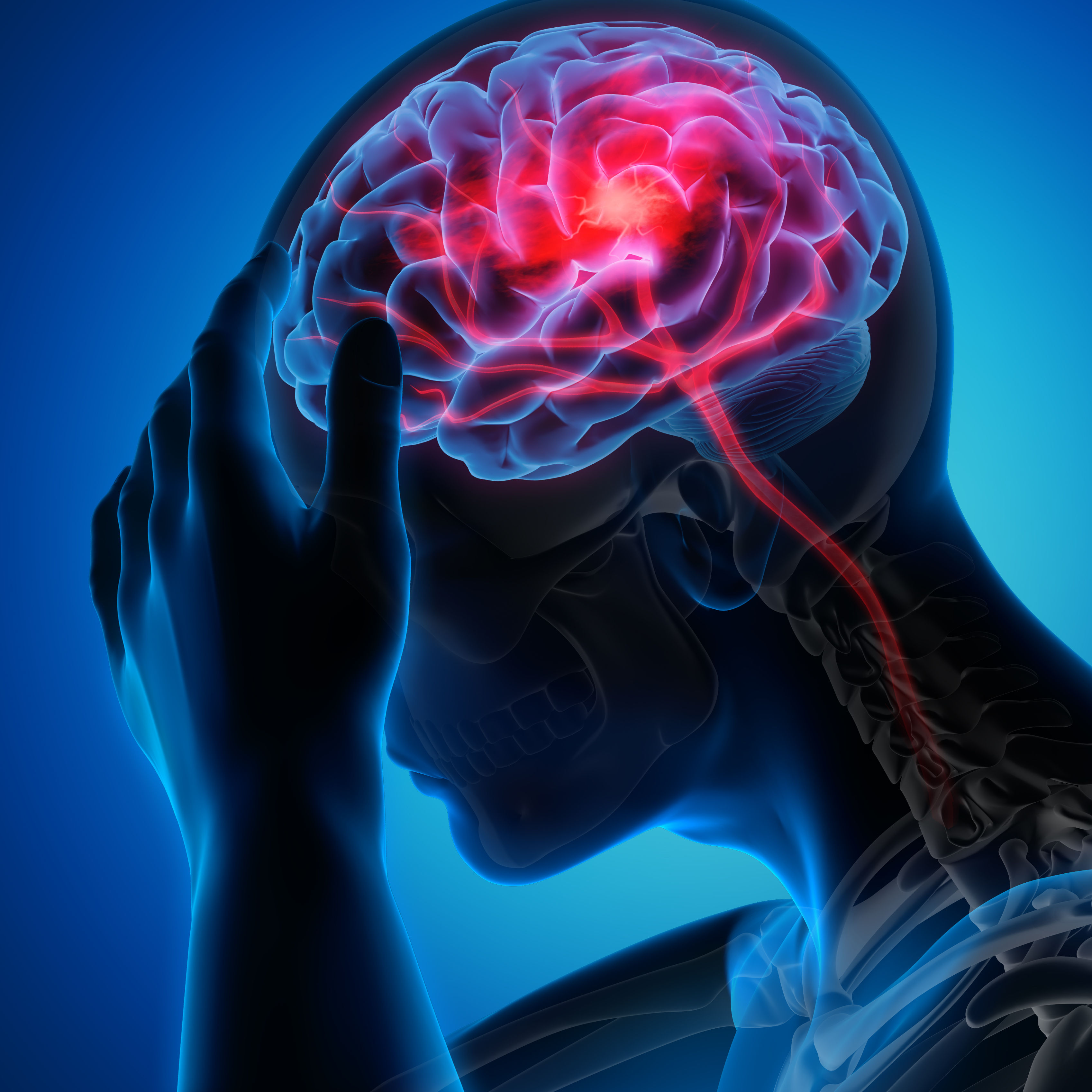 Man with brain stroke symptoms