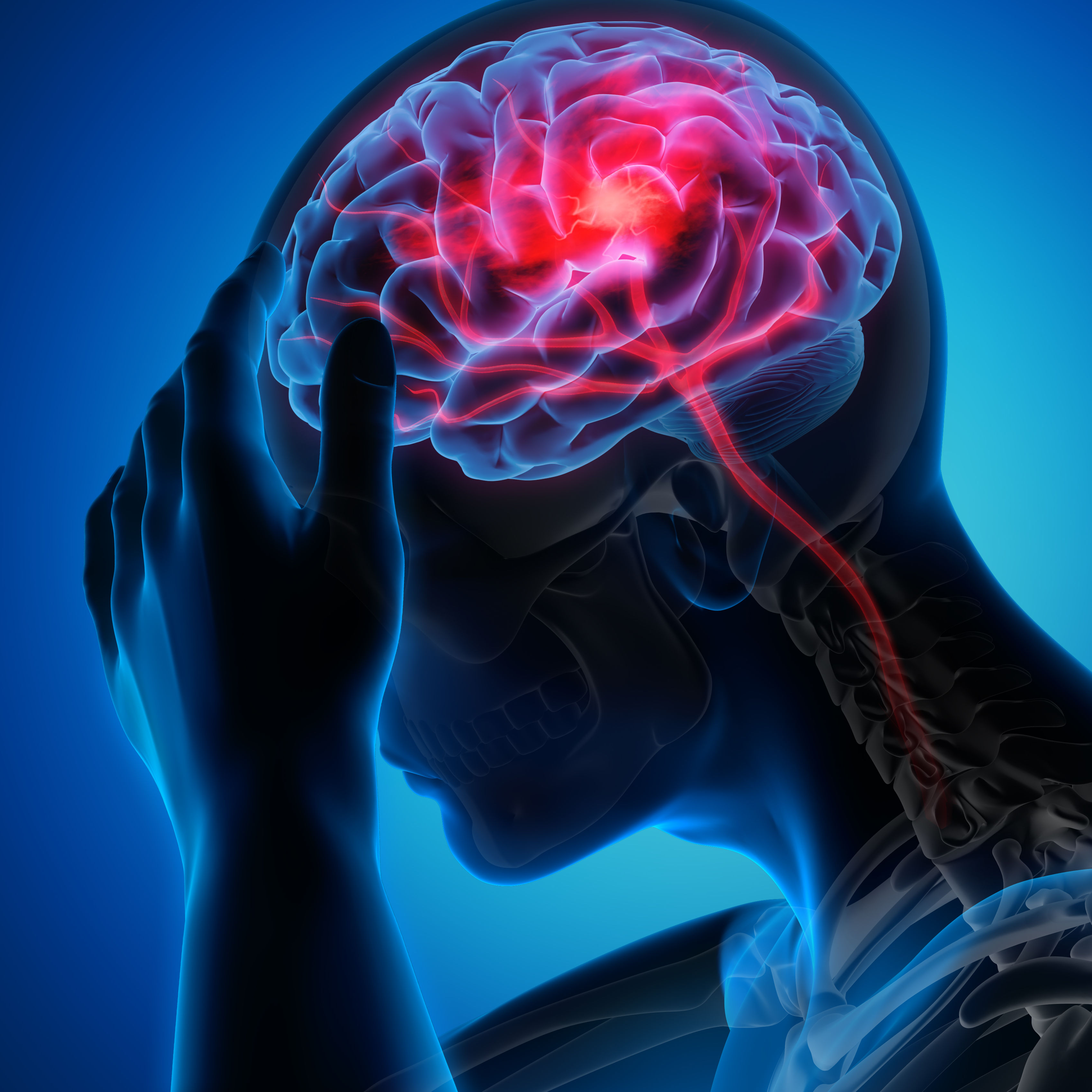 Man with brain stroke symptoms