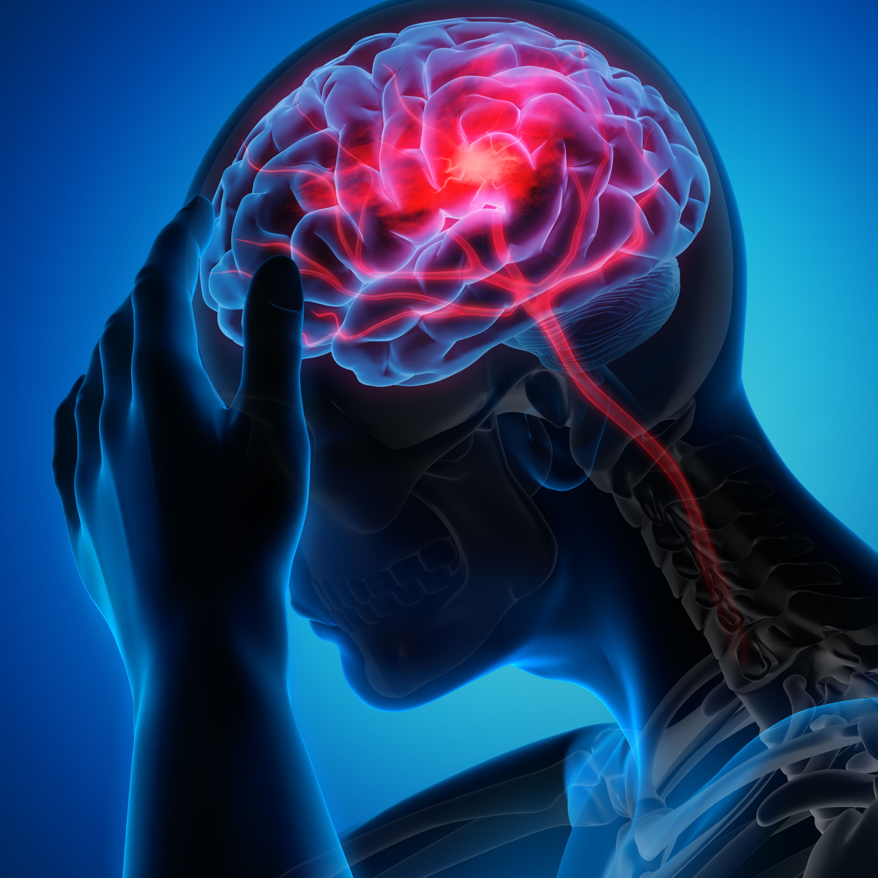 Man with brain stroke symptoms