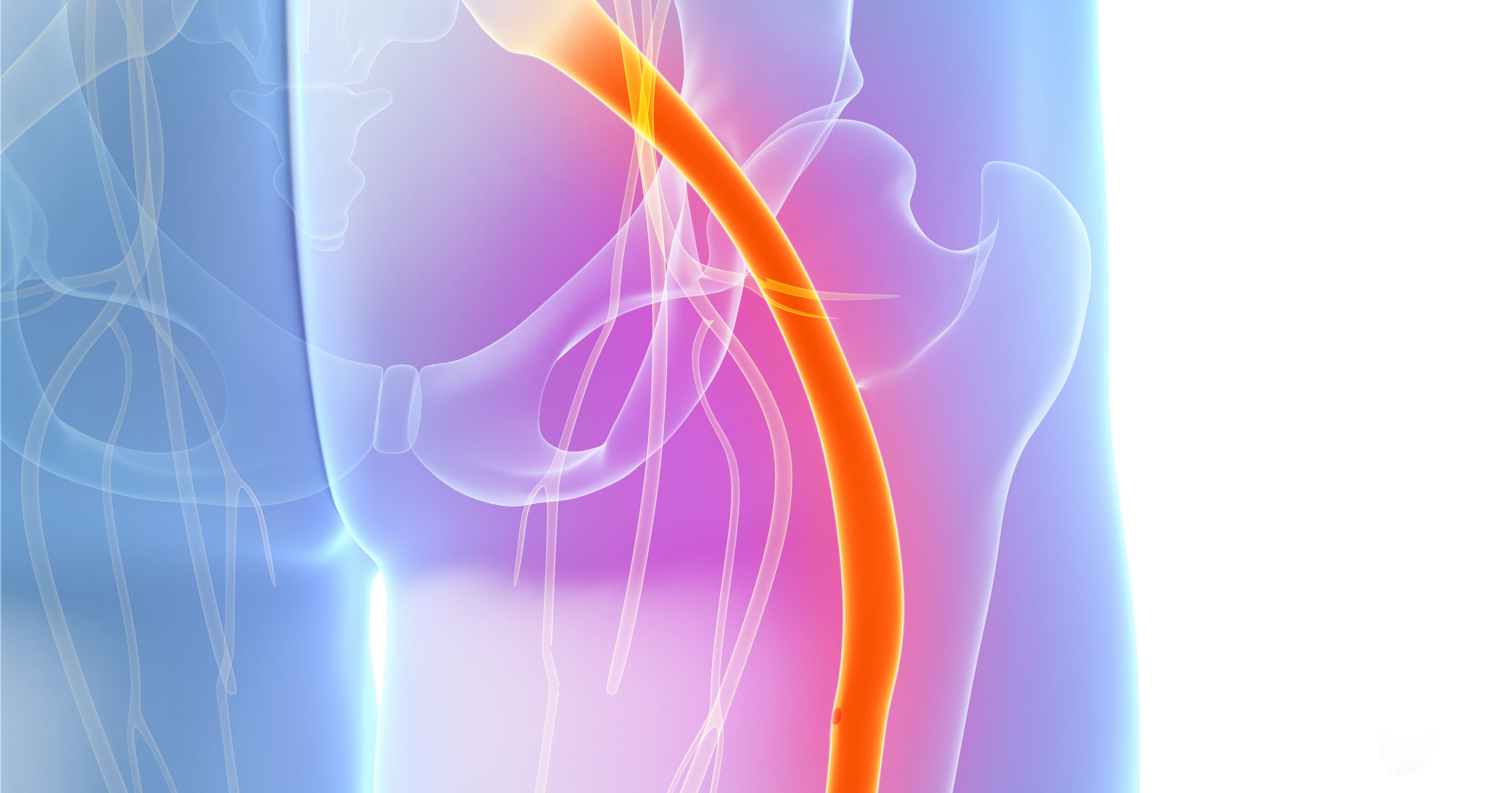 painful sciatic nerve