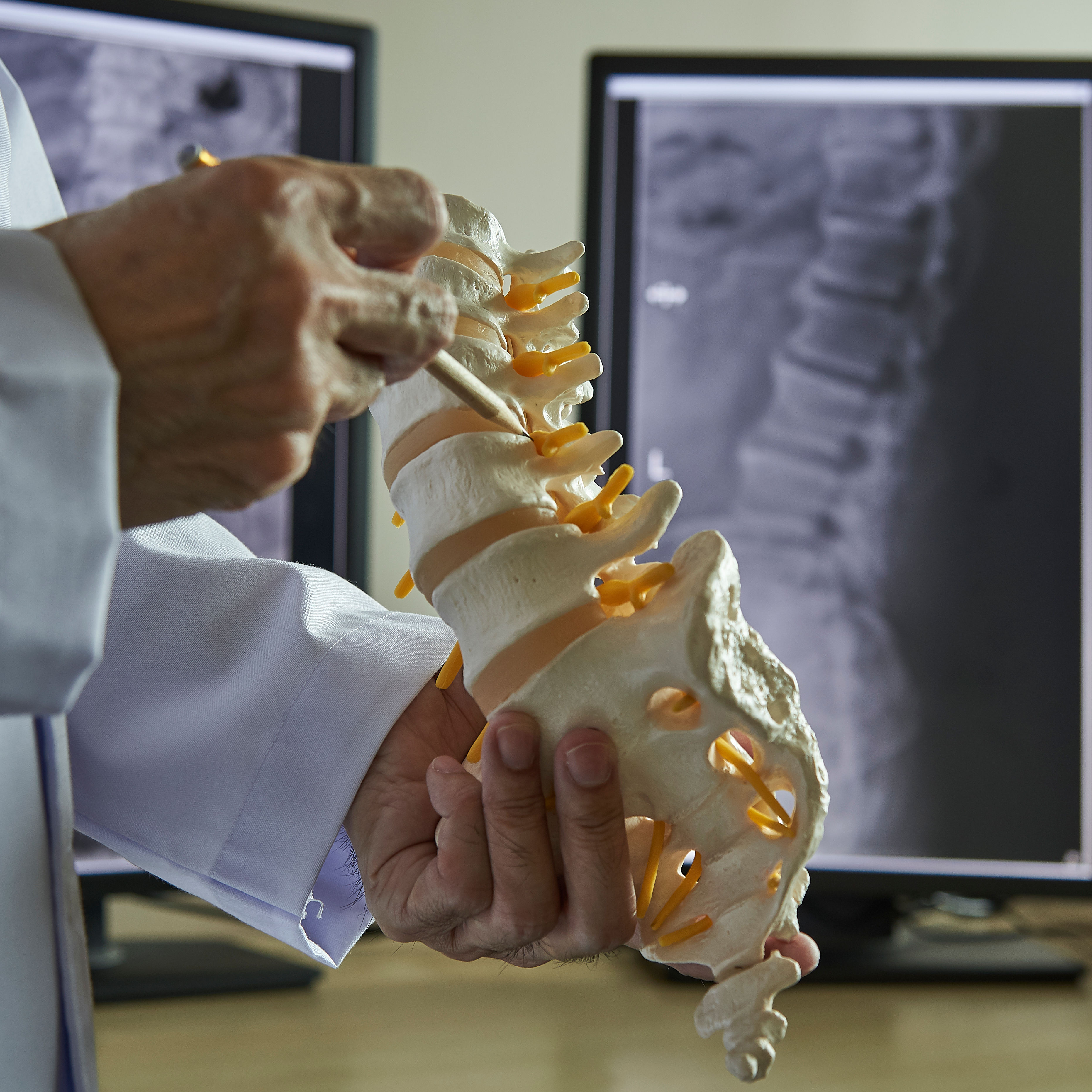A chiropractor pointing at lumbar vertebra model