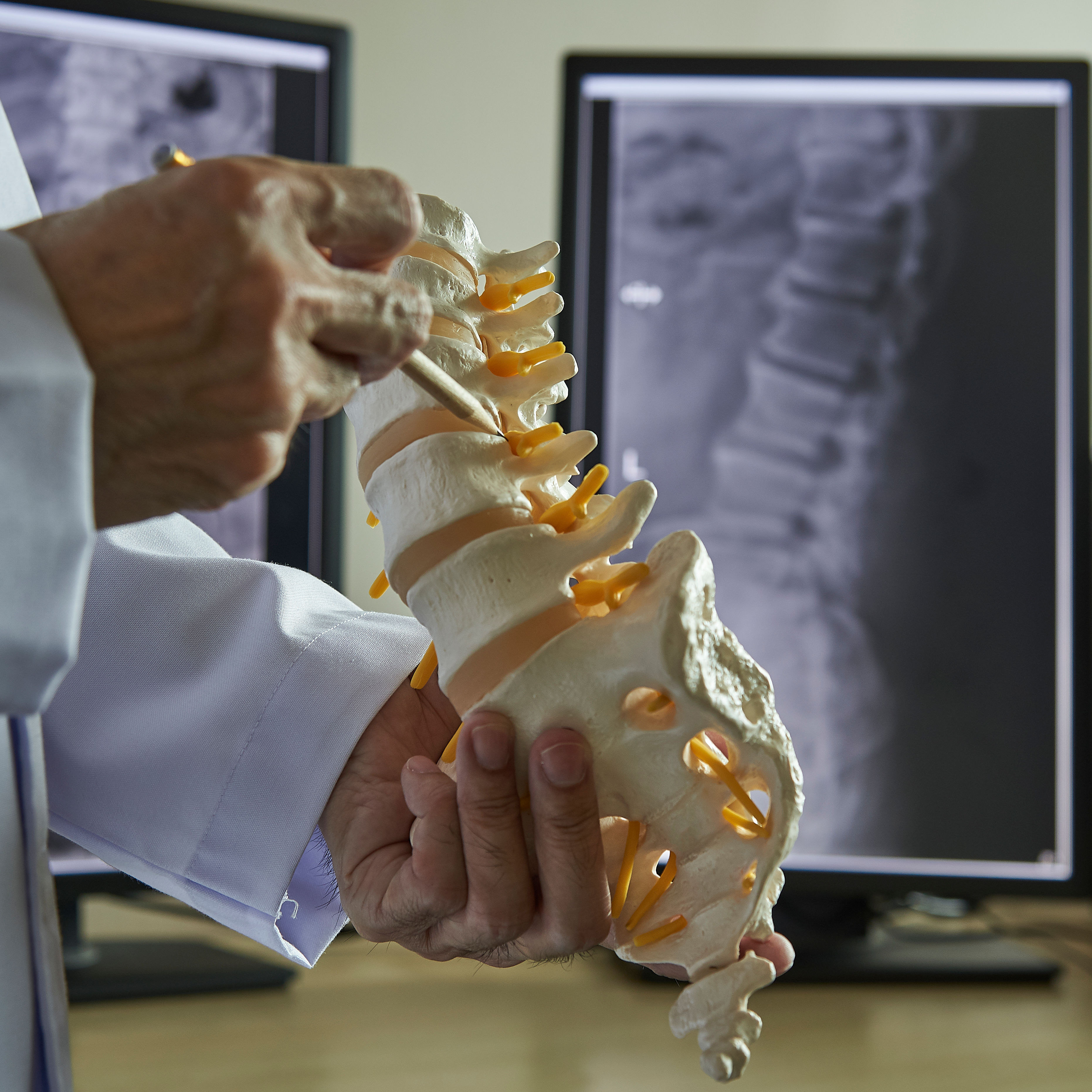 A chiropractor pointing at lumbar vertebra model