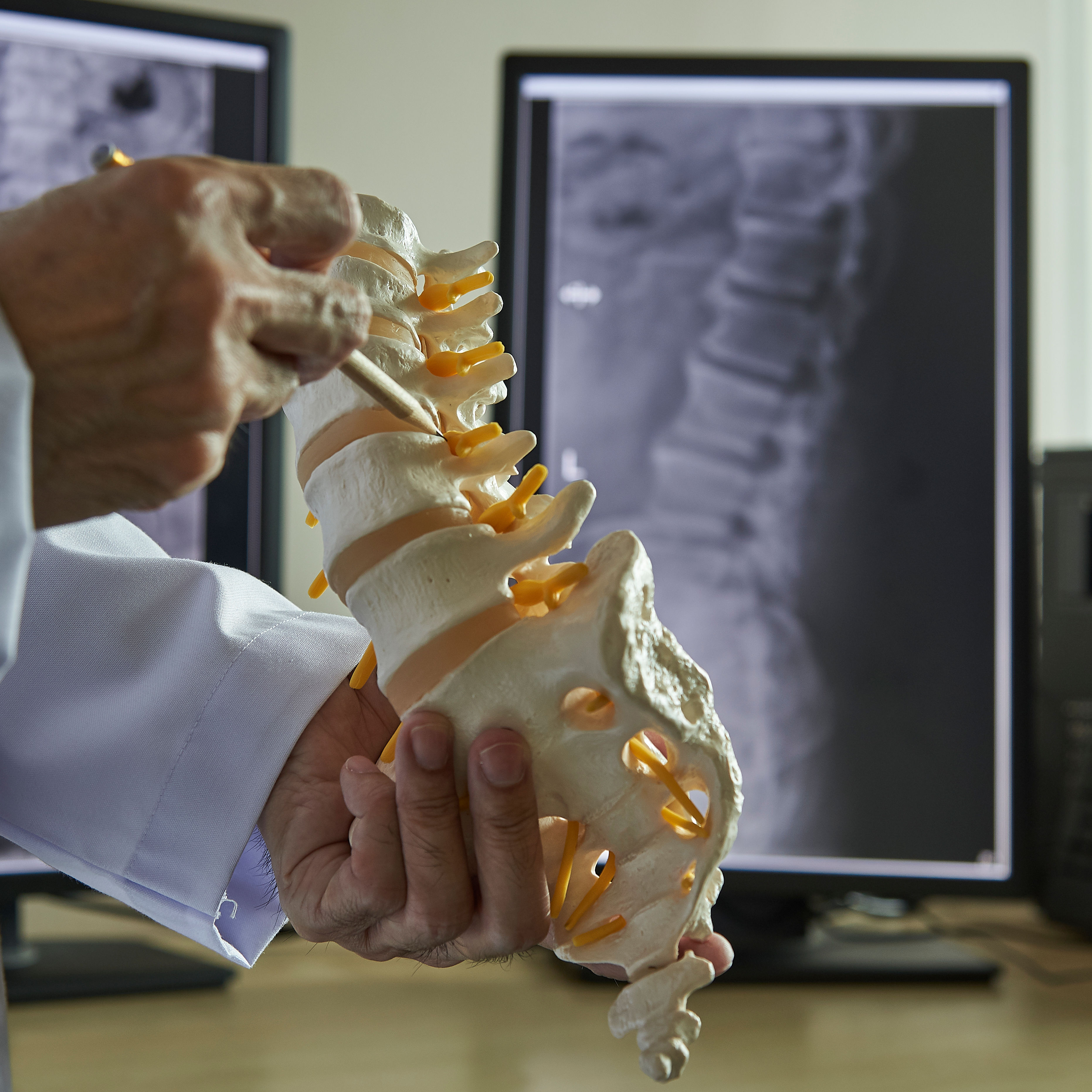 A chiropractor pointing at lumbar vertebra model