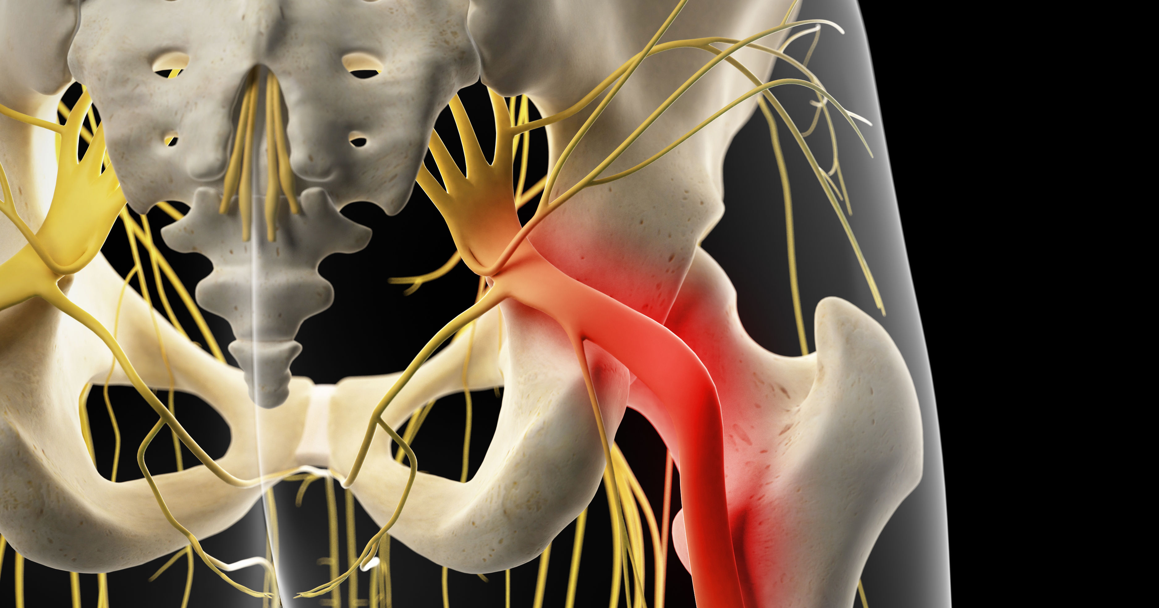 painful sciatic nerve