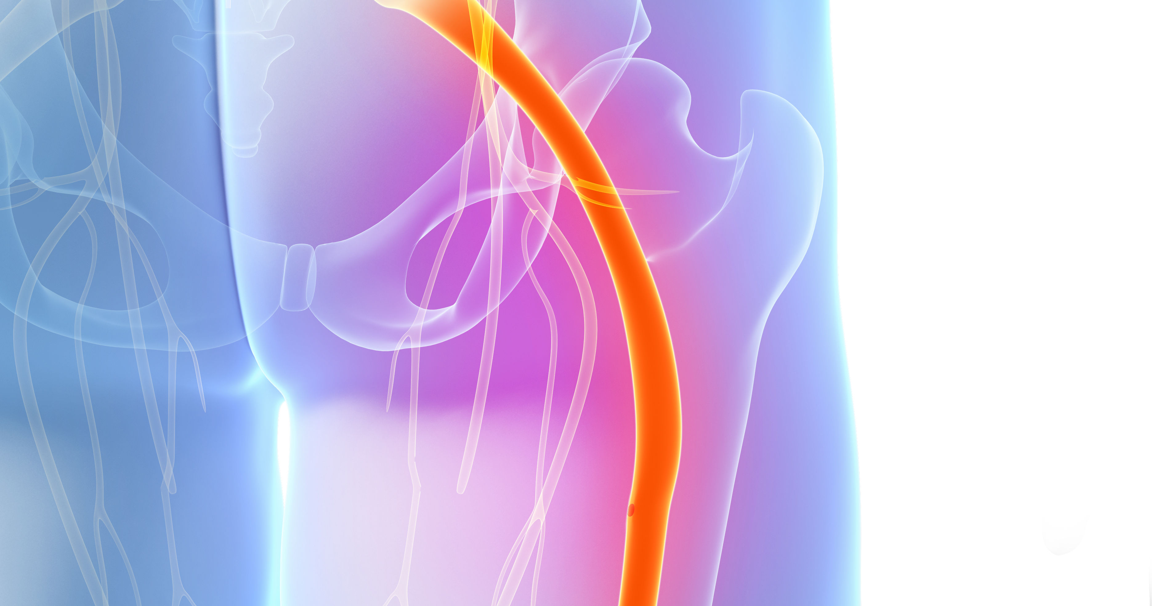 painful sciatic nerve