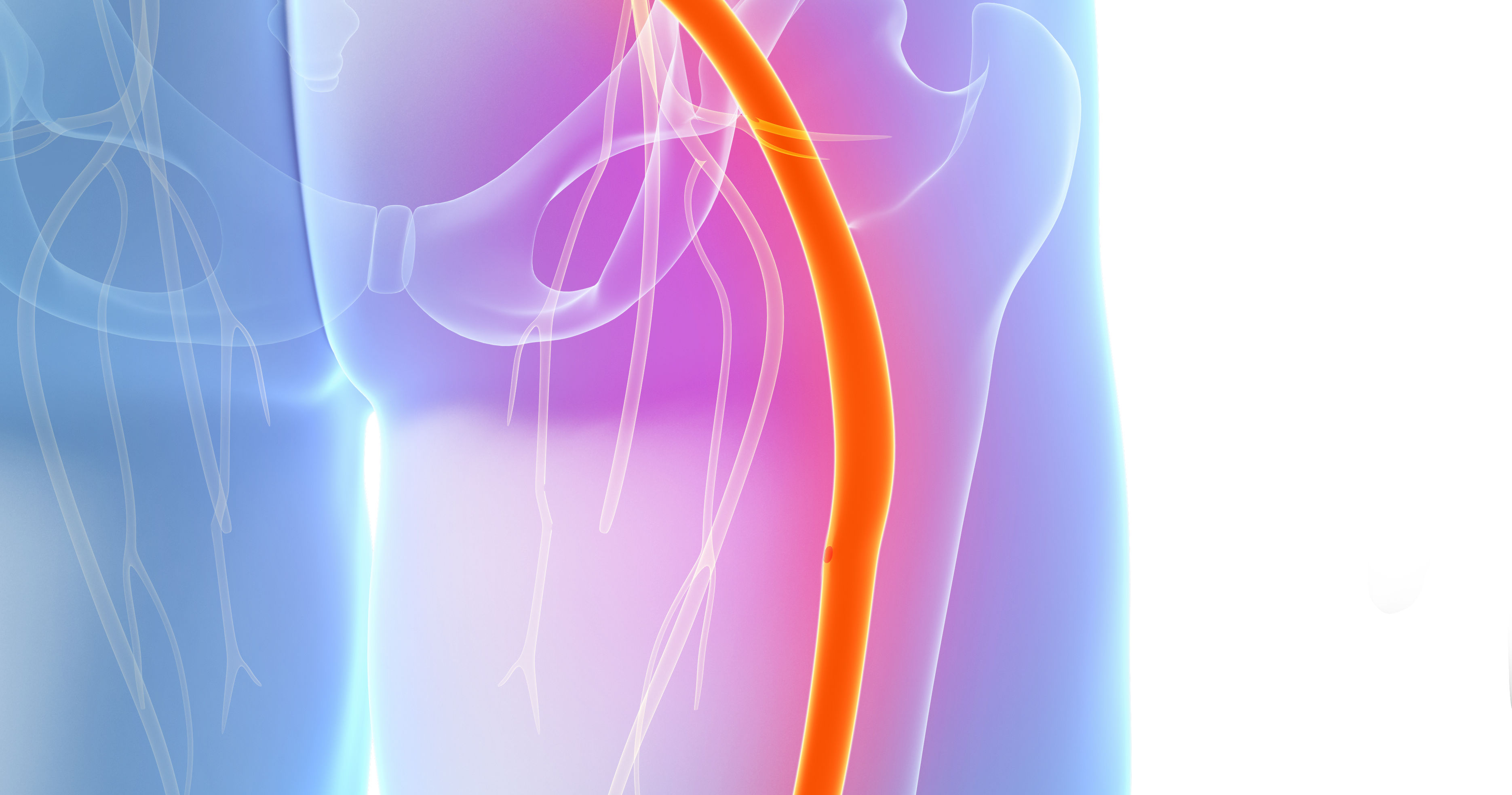 painful sciatic nerve