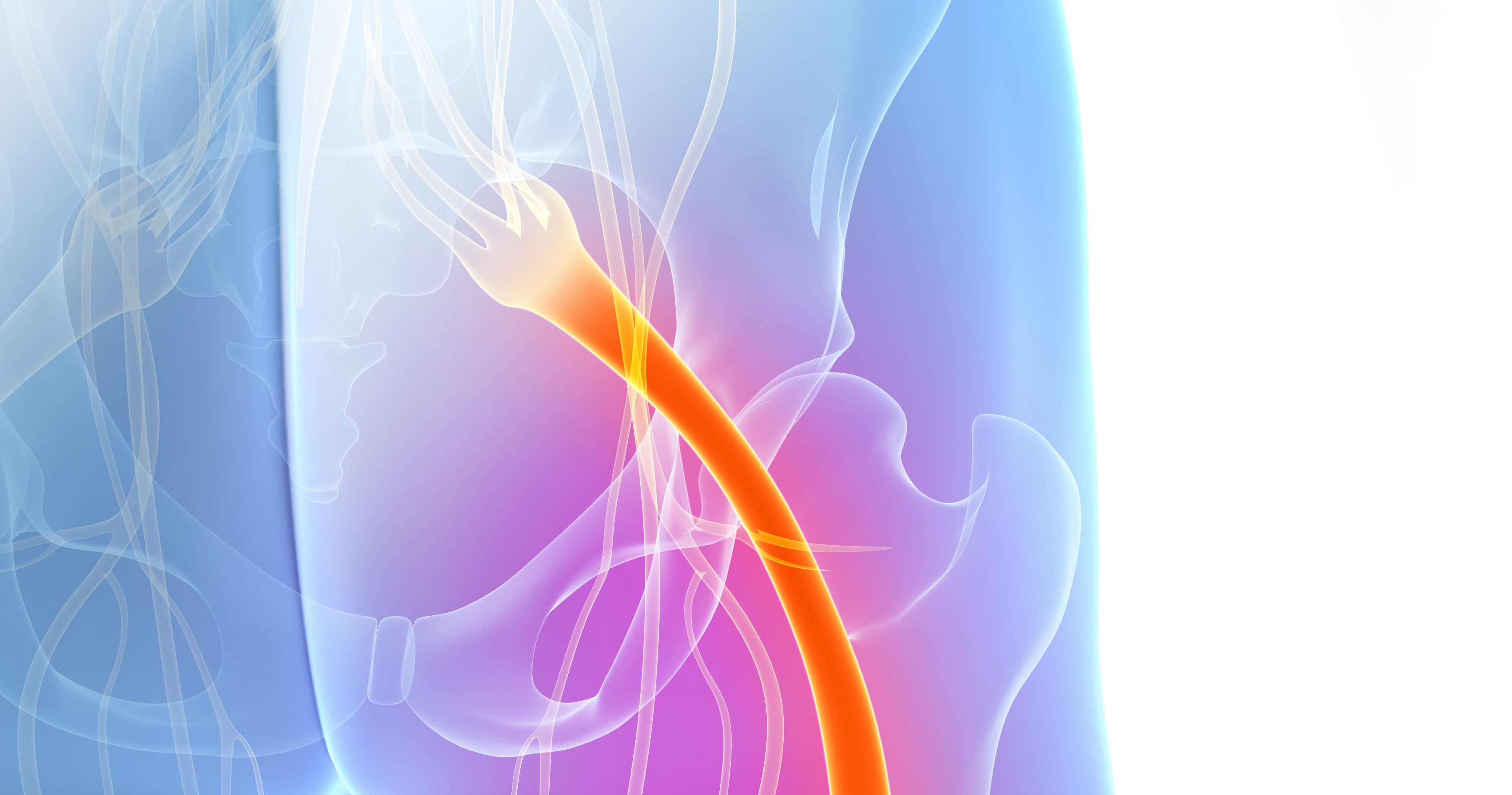 painful sciatic nerve