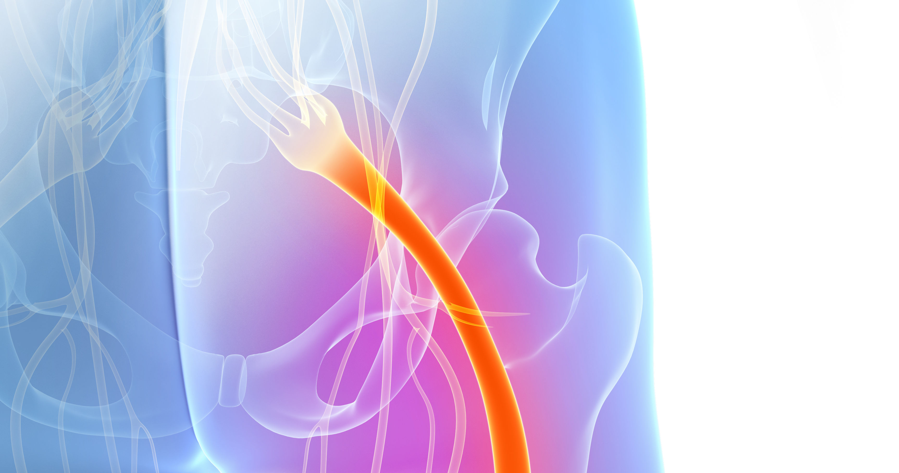 painful sciatic nerve