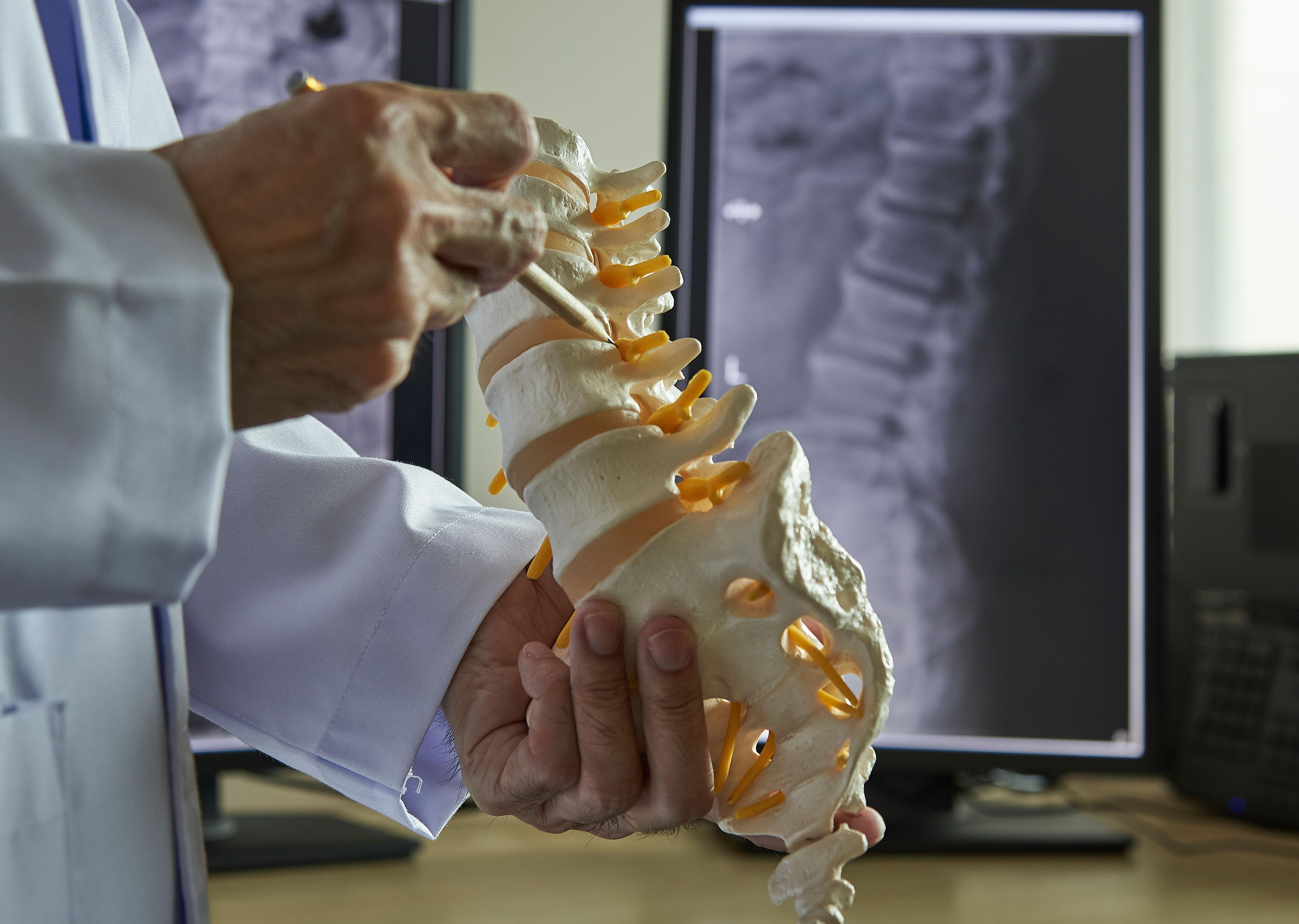 A chiropractor pointing at lumbar vertebra model
