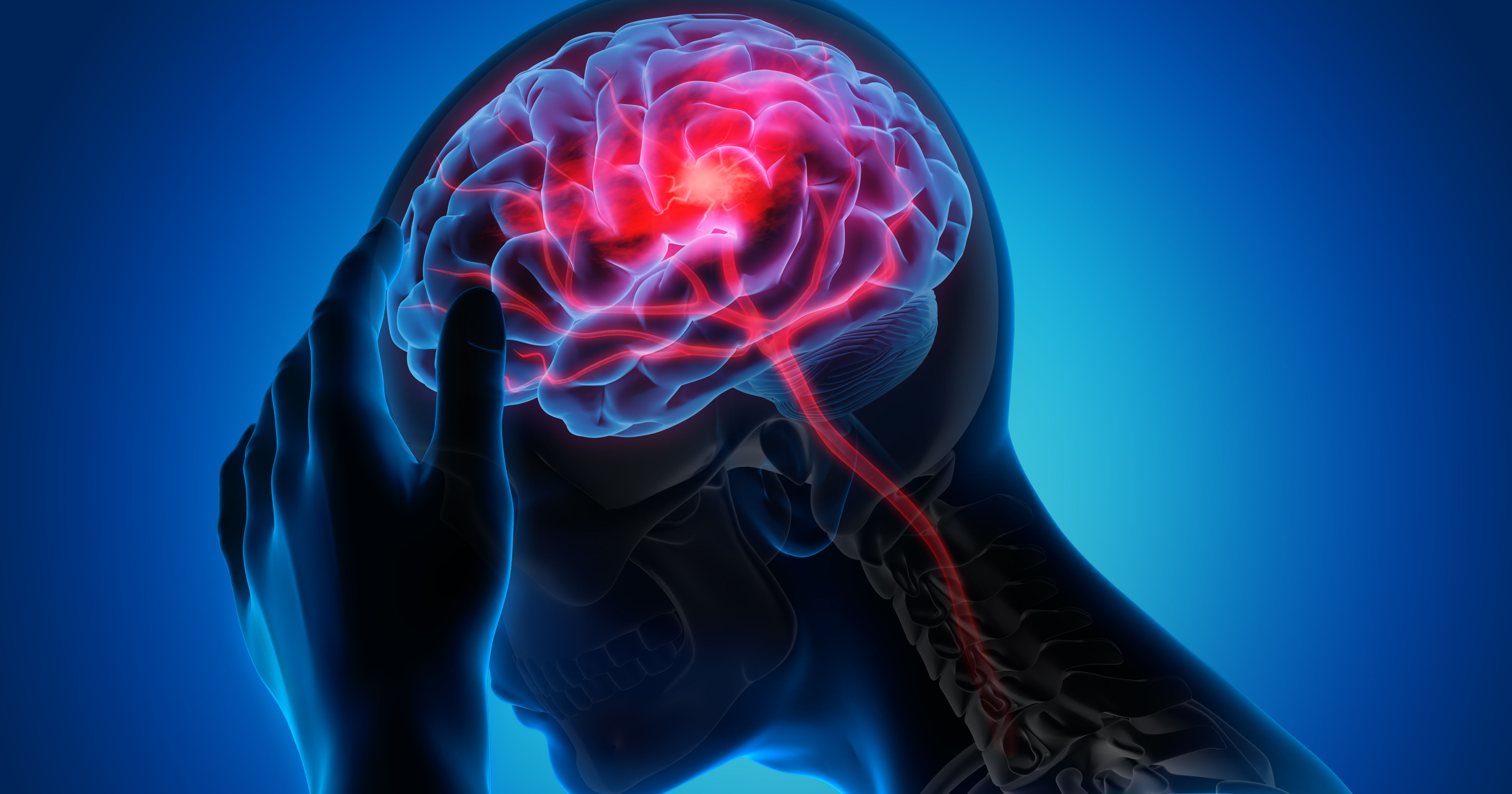 Man with brain stroke symptoms