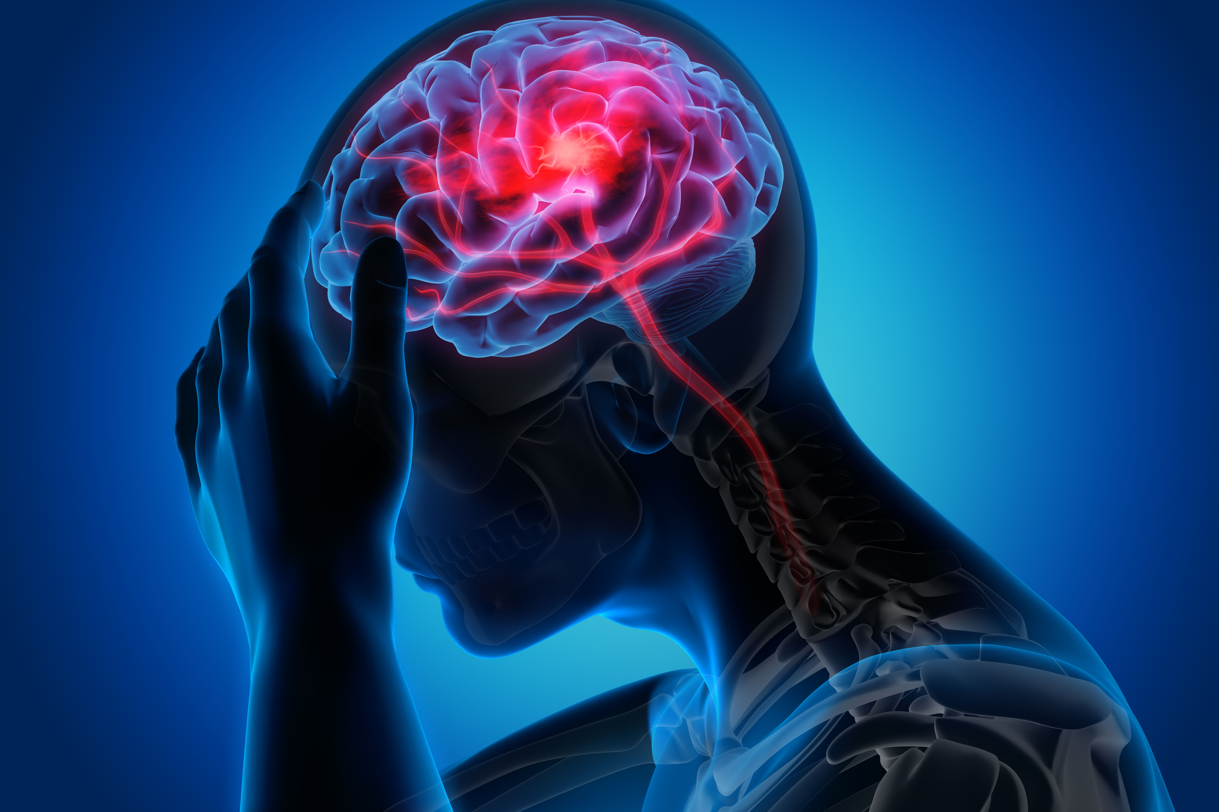 Man with brain stroke symptoms