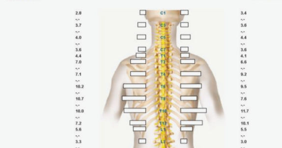 Computerized EMG scan assessing spinal muscle activity in Oakleigh chiropractic clinic