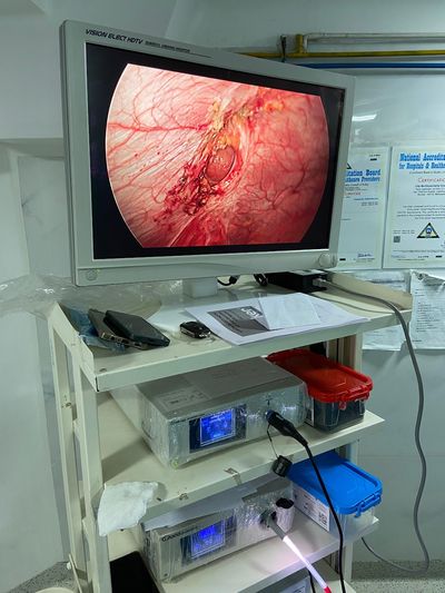 Stryker 1288 HD Full Endoscopy Tower