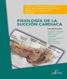 Fisiologa de la succin cardiaca