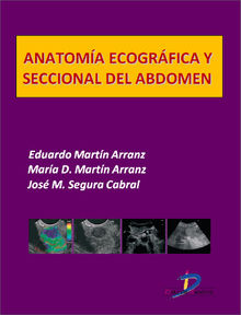 Anatoma ecogrfica y seccional del abdomen