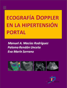 Ecografa Doppler en la hipertensin portal